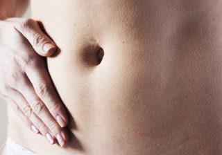 A Guide On Modified Coolsculpting
