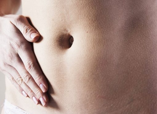 A Guide On Modified Coolsculpting